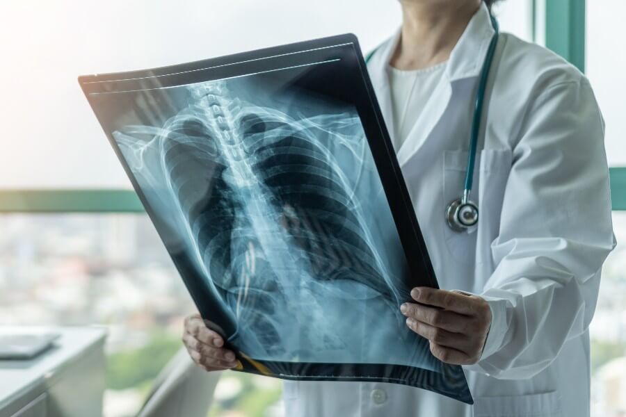 chances of recovery from mesothelioma
