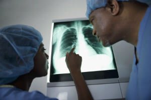doctors looking at a lung xray