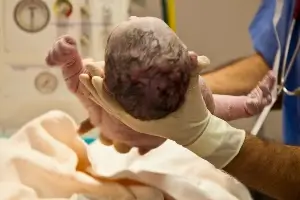 looking at the top of a baby's head as the infant is being held by a medical professional right after birth